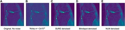 Evaluation of MRI Denoising Methods Using Unsupervised Learning